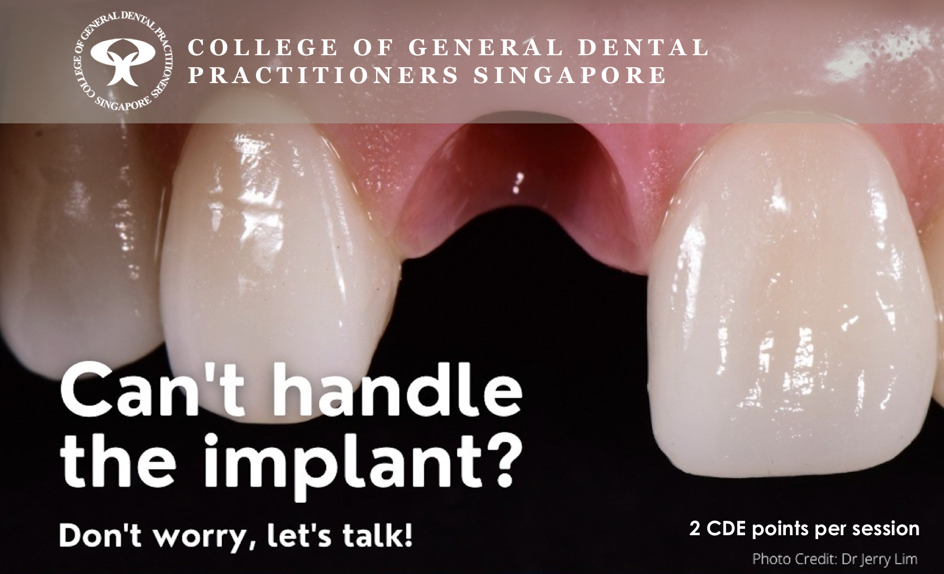 Webinar: Top 10 Things You Wish You Knew About Implants